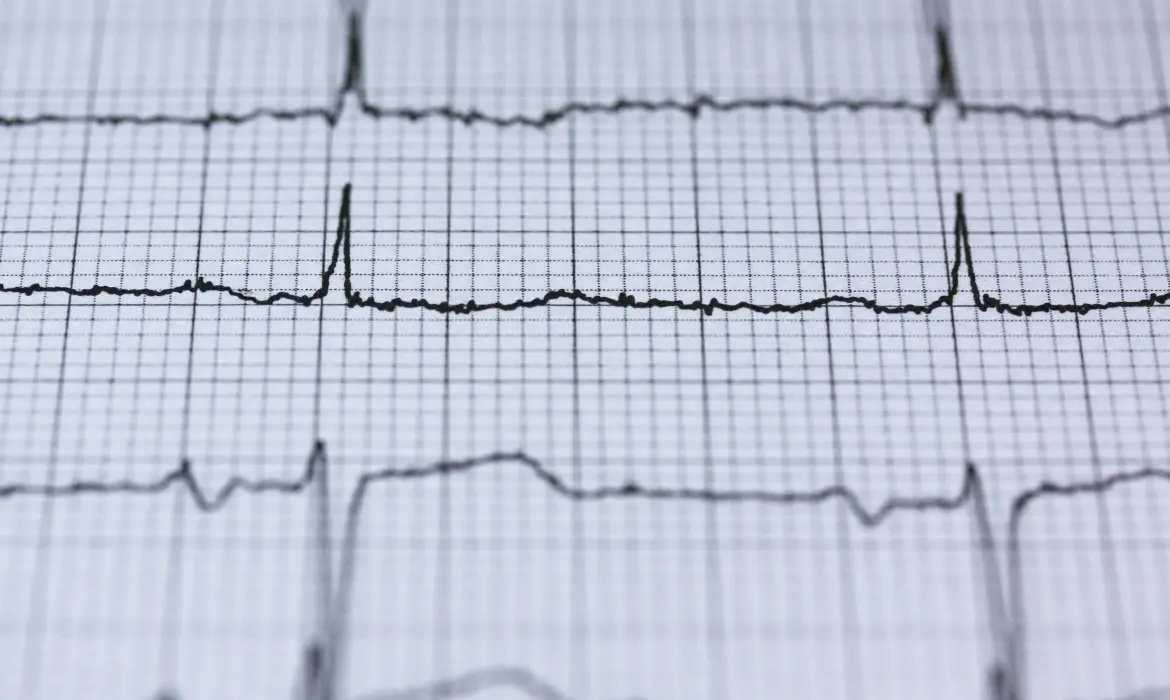 Elektrokardiyografi (EKG)